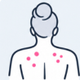 Body Acne & Breakouts